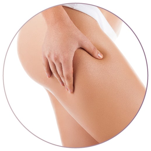 Medicina estetica per trattamento cellulite